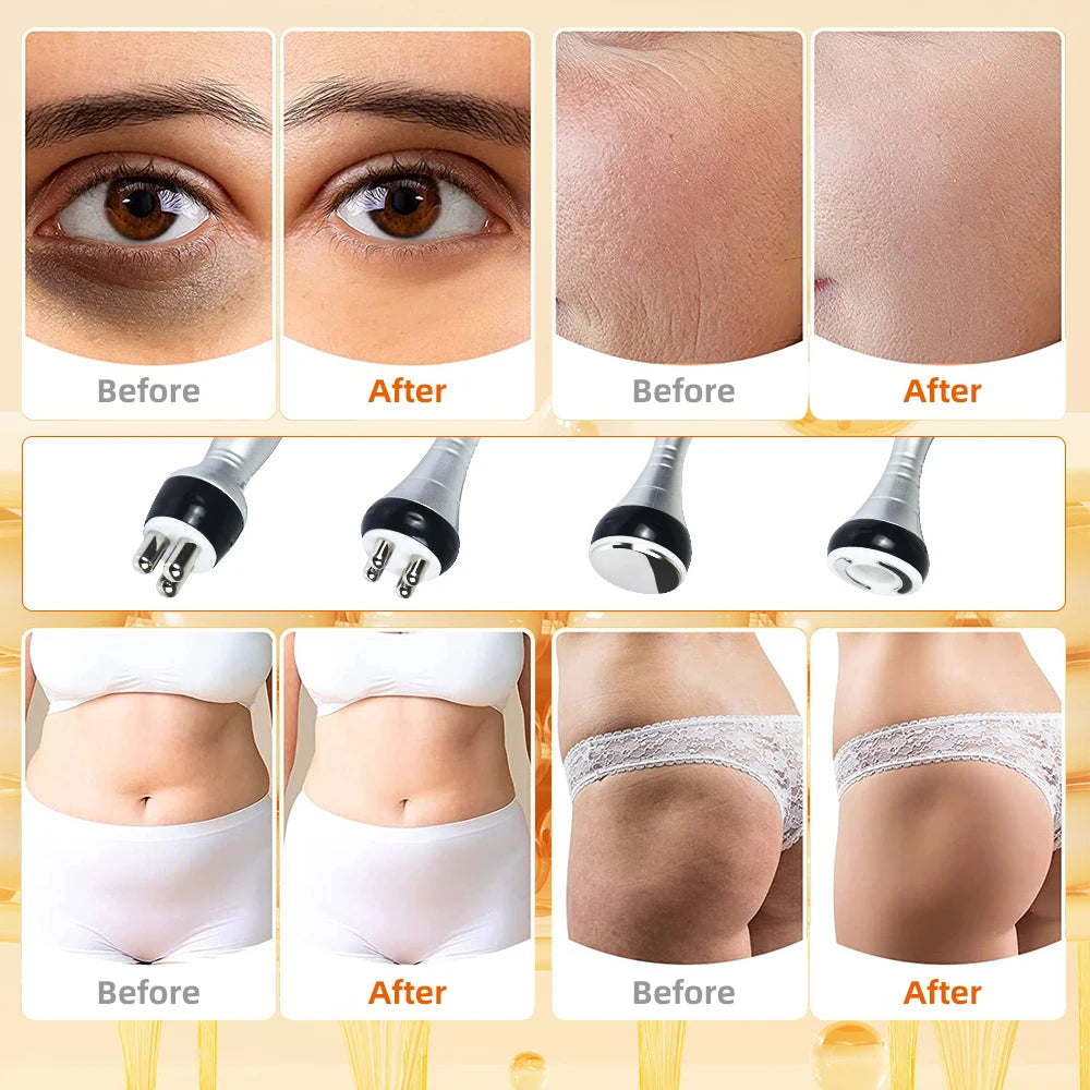 40K 4IN1 Cavitation Body Slimming Machine Beauty Massager Skin Tighten Face Lifting Vacuum Suction With Gel (Fast Shipping)