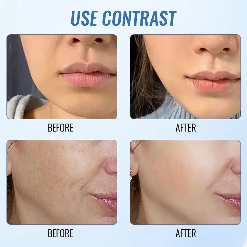 Upgraded Double Ball Roller Face Slimming Device Microcurrent V-Face Beauty Device Massager Lifting and Tightening Removesema