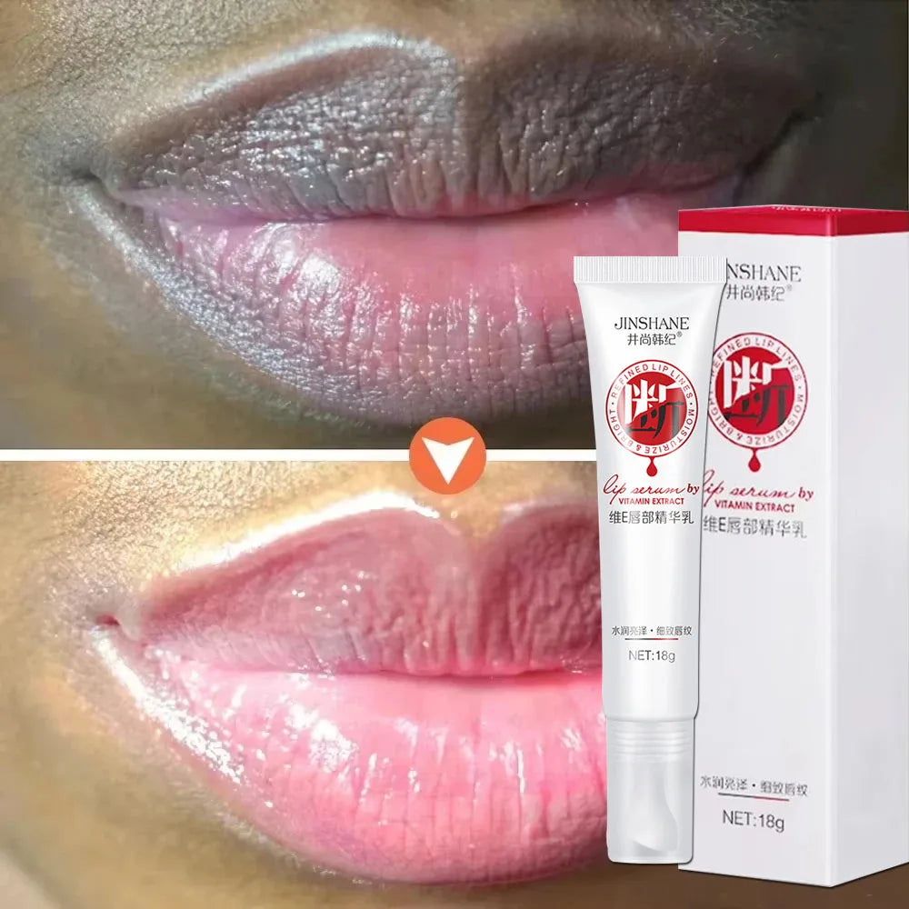 Vitamin E Lightening Bleaching Cream Remove Dark Lip Balm Exfoliating Clean Deep Moisturizing Nourishing Makeup Beauty Health