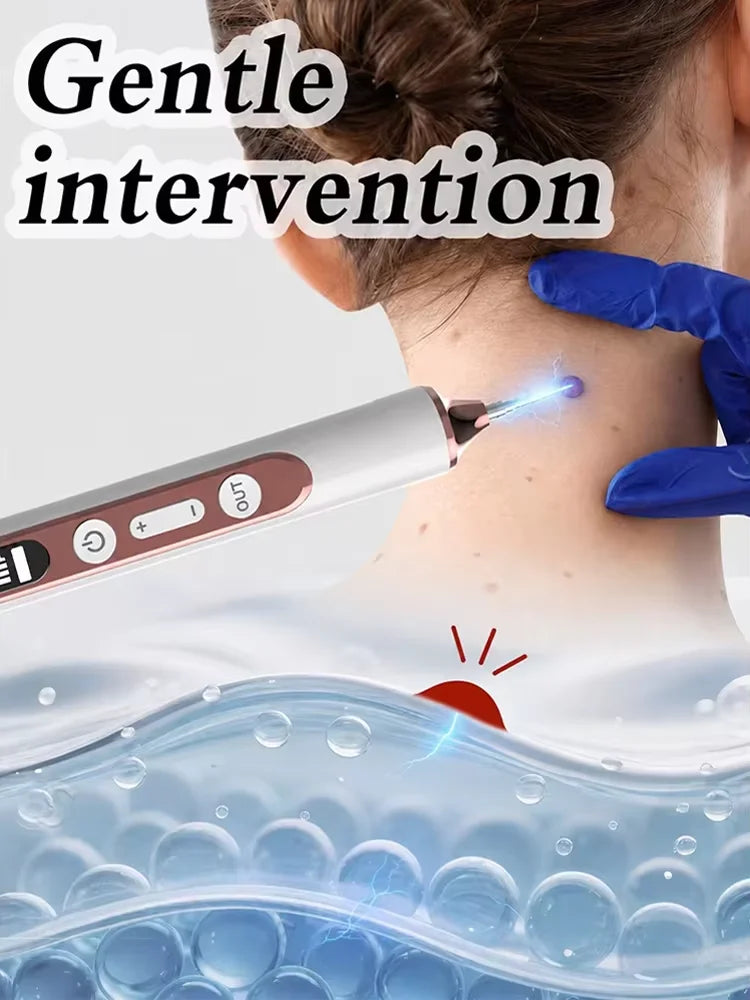 Plasma Pen for Warts Remover Mole Removal Pen Skin Tag Freckle Spot Care Electric Arc Beauty Tool